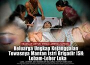 Kasus Winda Lorenza di Medan, Perbedaan Keterangan Keluarga dan Polisi Mencuat